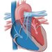 Sof Medica - Chirurgia robotica